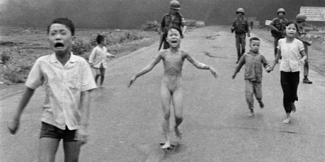 Gense napalm-pigen 40 år efter Vietnamkrigen