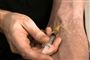 Staten skal punge ud til heroin