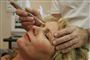 Botox kan sprede sig fra ansigtet til hjernen