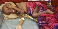 Røde Kors siger selv, at de ventede for længe, før de startede en indsamling til fordel for børn som dette i Somalia. "Undskyld, at vi undervurderede folks villighed og forståelse for sulten," siger generalsekretær i Røde Kors, Anders Ladekarl til Newspaq.
