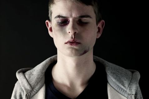 En 14-årig dreng slap heldigt fra et overfald. Modelfoto.