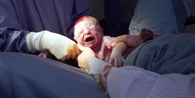 En baby med vejrtrækningsproblemer blev sendt hjem før tid - stress på Hvidovre skaber flere fejl