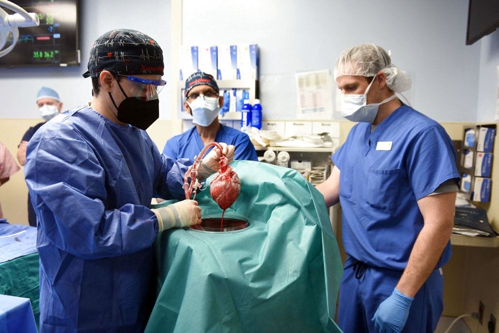 Kirurger fra University of Maryland School of Medicine ses under operationen af David Bennett.