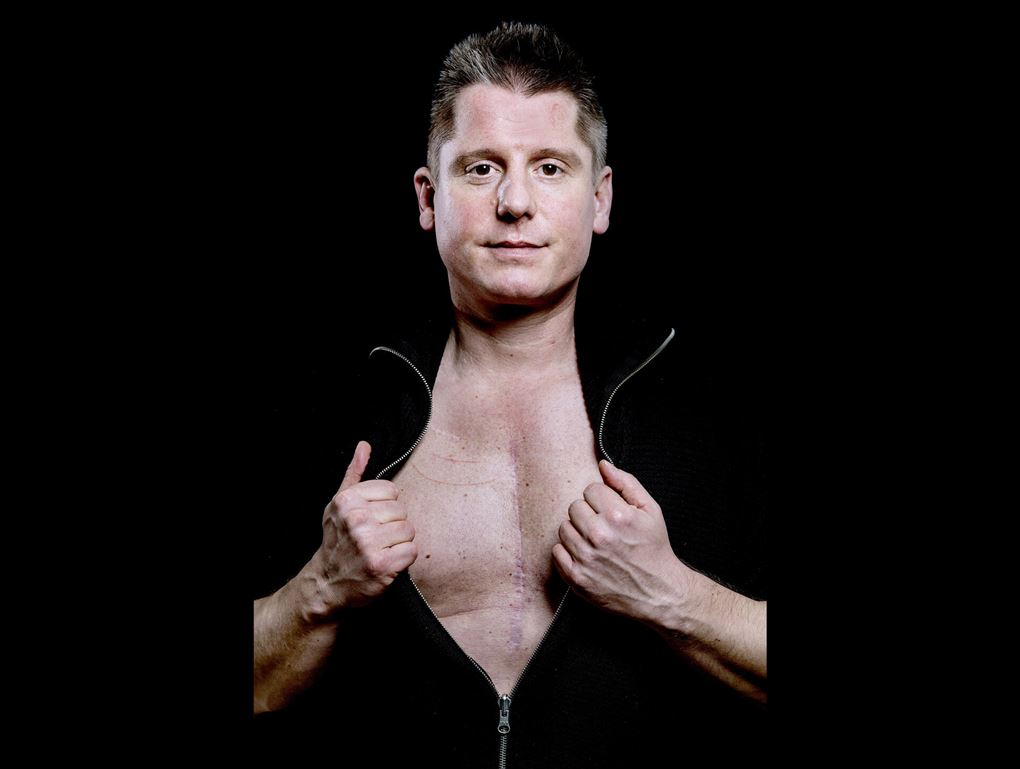 Robert Hansen med åben skjorte, som han hiver i.