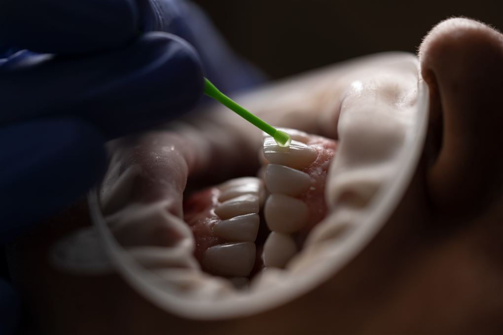 en patient får behandlet tænder