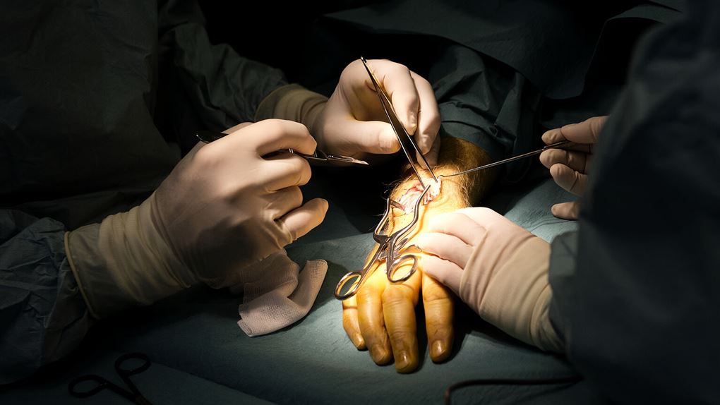en operation